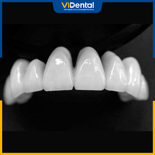 Răng sứ Nacera là loại răng có nguồn gốc từ Đức