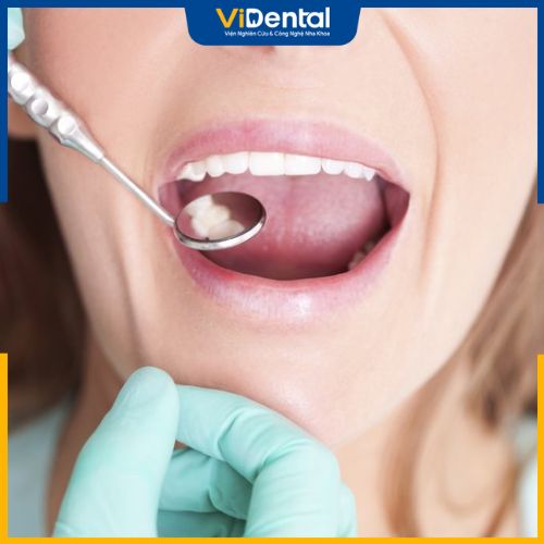 Tình trạng răng miệng là yếu tố quyết định đến giá trồng răng