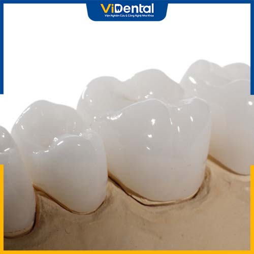 Răng toàn sứ được xếp vào răng cao cấp do được chế tạo hoàn toàn từ sứ nguyên chất 100%