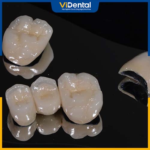 Răng sứ titan là một trong những loại răng sứ xuất hiện lâu đời