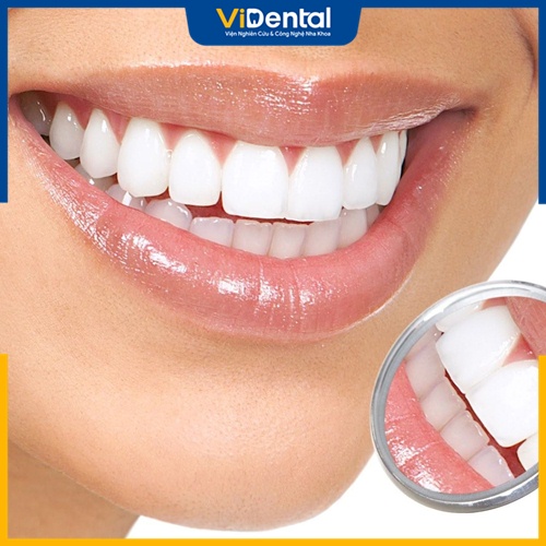 Răng sứ có bị ố vàng không còn tùy thuộc vào nhiều yếu tố 