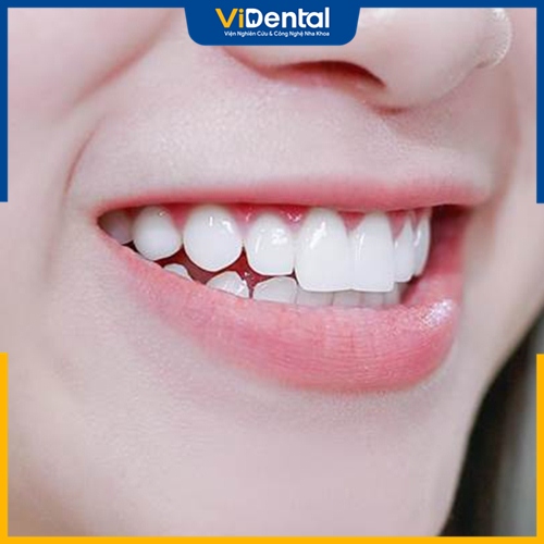 Chăm sóc răng không đúng cách cũng khiến răng sứ bị ố vàng