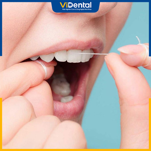 Sau khi bọc răng sứ, cần tiến hành vệ sinh răng miệng sạch sẽ
