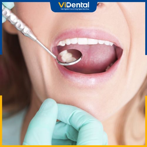 Điều trị bọc răng sứ bị nhiễm trùng tại nha khoa