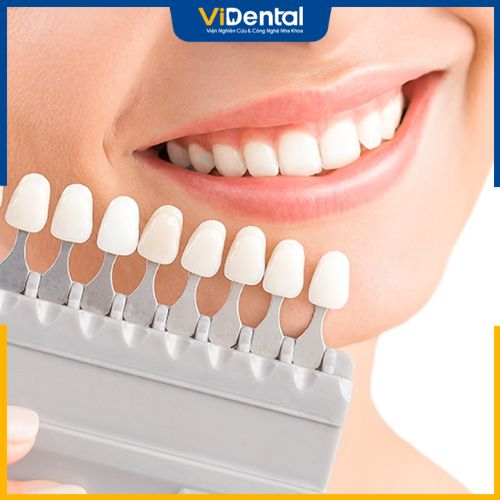 ViDental Clinic - Địa chỉ dán răng sứ không mài răng an toàn, hiệu quả