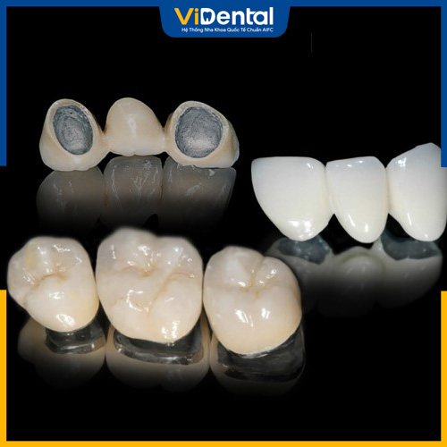 Sử dụng vật liệu kém chất lượng khiến răng bị hỏng