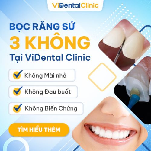 ViDental Clinic - Địa chỉ bọc răng sứ đẹp, an toàn