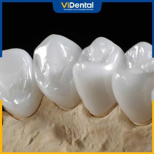 Dòng răng sứ này được cấu tạo từ khối thủy tinh Lithium Disilicate