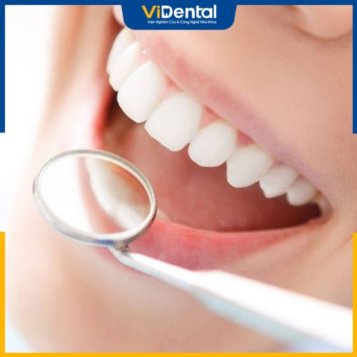 Răng sứ Nacera là dòng răng toàn sứ đến từ hãng Doceram (Đức)