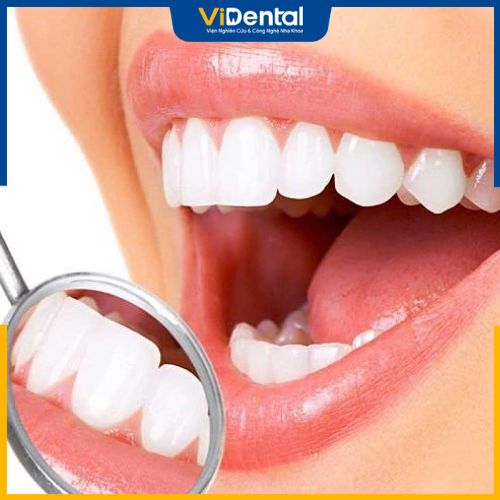 Bọc răng cả hàm giúp khắc phục tình trạng răng mọc lệch, răng xấu
