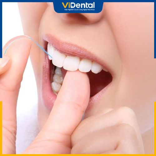 Vệ sinh răng mỗi ngày để kéo dài tuổi thọ cho răng sứ