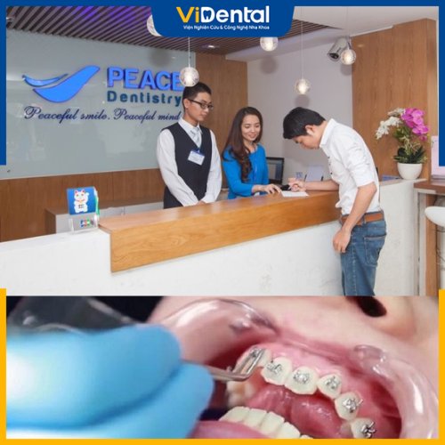 Dịch vụ niềng răng tại trung tâm Peace Dentistry được nhiều người phản hồi tốt