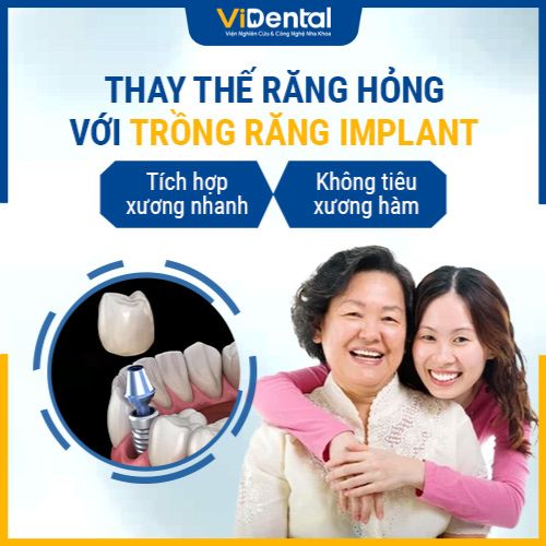 ViDental Clinic - Địa chỉ trồng răng implant “GIÁ RẺ” CHẤT LƯỢNG NHẤT TP.HCM