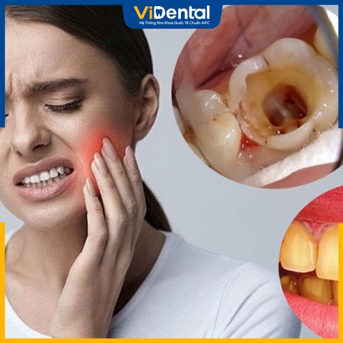 Những đối tượng gặp vấn đề nha khoa cần bọc răng sứ lần 2