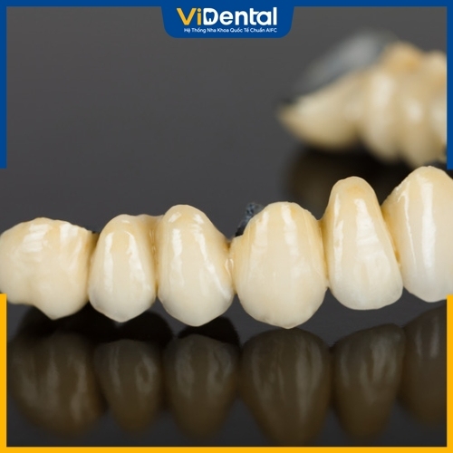 Bọc răng sứ bị tụt lợi được cho là liên quan tới chất liệu răng sứ kém chất lượng