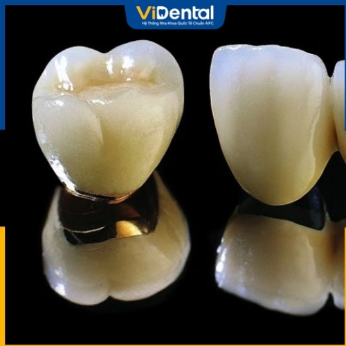Răng sứ kim loại quý là sản phẩm đặc biệt trong dòng kim loại