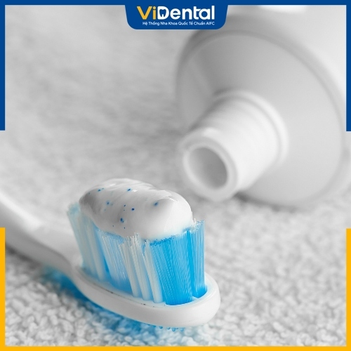 Kem đánh răng có chỉ số RDA cao cũng gây mòn răng