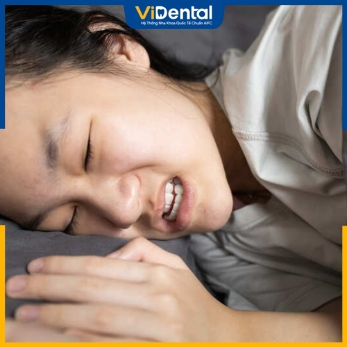 Ngủ nghiến răng sẽ khiến răng bị mài mòn