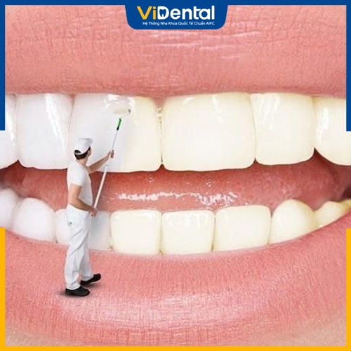 Tẩy trắng răng giúp khắc phục răng ố vàng hiệu quả 