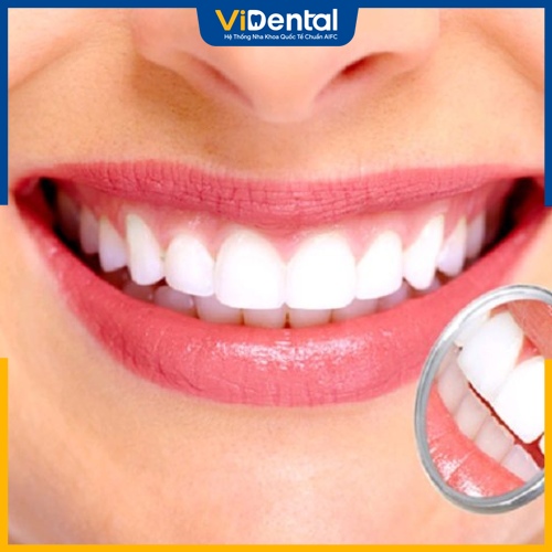 Bọc răng sứ giúp cải thiện màu sắc răng 
