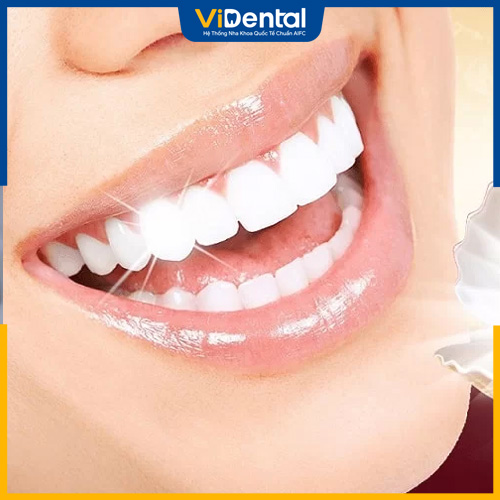 Dòng răng sứ này có nhiều ưu điểm nổi bật