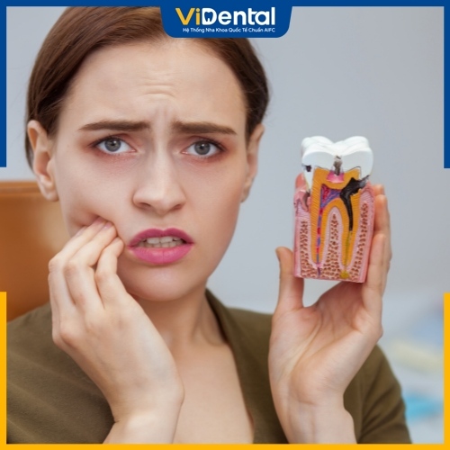 Có nhiều nguyên nhân khiến răng bị sâu