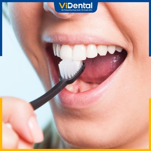 Cách giữ răng sứ luôn trắng sáng bằng vệ sinh răng miệng khoa học
