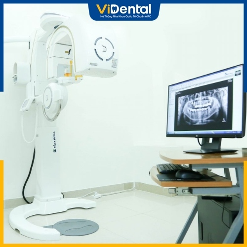 Máy chụp X-quang răng Conebeam CT 3D tại Nha khoa ViDental