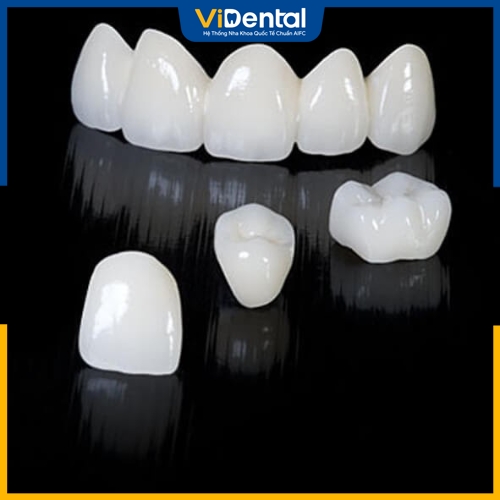 Răng toàn sứ được lựa chọn để phục hình trên Implant 