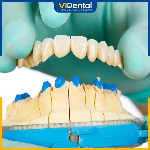 Tháo răng sứ làm lại là giải pháp xử lý răng sứ hỏng tối ưu nhất
