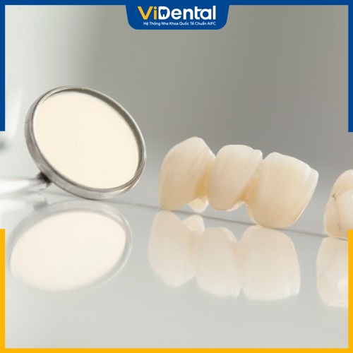 Răng sứ Centonia là dòng răng toàn sứ có chi phí rẻ 