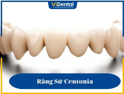 Răng sứ Centonia có nguồn gốc từ Hàn Quốc
