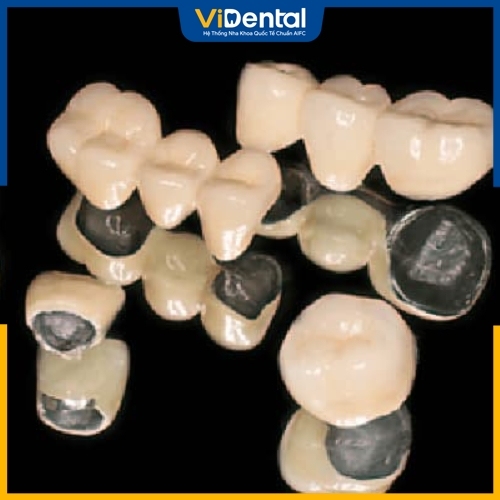 Zirconia Ceramco khắc phục được nhiều nhược điểm của răng sứ kim loại