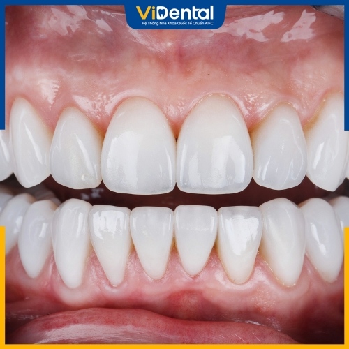 Ceramco đảm bảo lành tính và an toàn với sức khỏe răng miệng