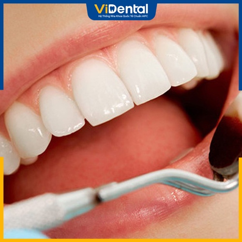 Lên kế hoạch chăm sóc răng thật kỹ để tăng tuổi thọ răng bọc sứ