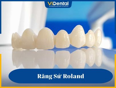 Răng sứ Roland được nhiều khách hàng quan tâm