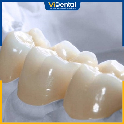 Giá bọc răng sứ có sự thay đổi phụ thuộc nhiều yếu tố