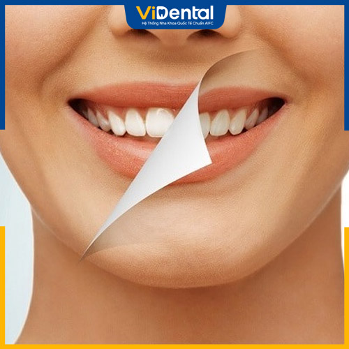 Tẩy trắng răng không gây đau nhức cho khách hàng