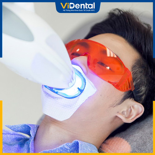 Dùng Laser tẩy trắng răng được thực hiện tại các cơ sở nha khoa