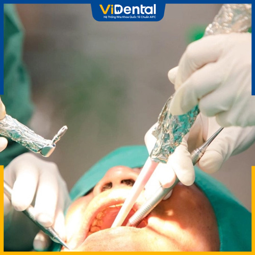 Quy trình trồng răng Implant cần đúng chuẩn Y khoa