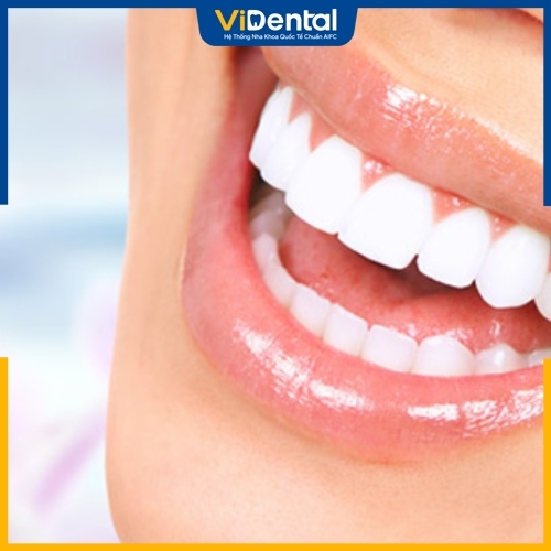 Bọc răng sứ cho răng cửa bị mẻ mang lại hiệu quả vượt trội