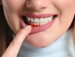 Khách hàng gặp vấn đề răng miệng cần chi trả thêm phí xử lý