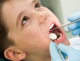 Lấy cao răng cho trẻ em có chi phí thấp hơn