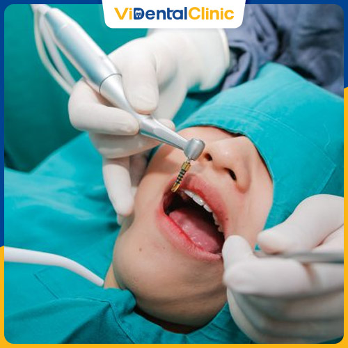Trồng răng Implant có thể áp dụng cho nhiều trường hợp