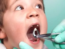 Mỗi nha khoa có mức giá nhổ răng khác nhau
