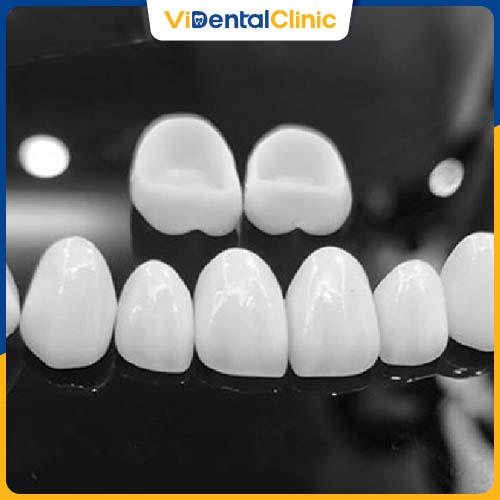 răng toàn sứ Centonia ra đời dựa trên công nghệ CAD/CAM