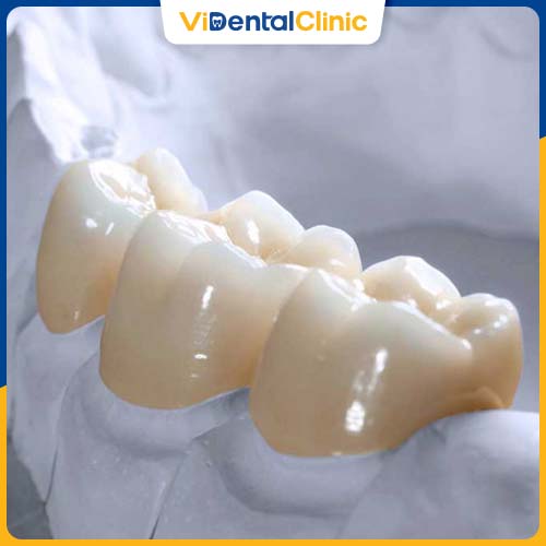 Răng sứ DDBIO Zirconia là dòng răng thế hệ mới