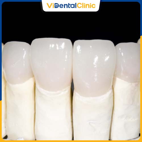 Răng sứ Zirconia được chế tác từ chất liệu Zirconia