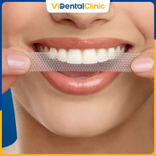 Miếng dán tẩy trắng răng được làm từ vật liệu nha khoa, có tính dẻo