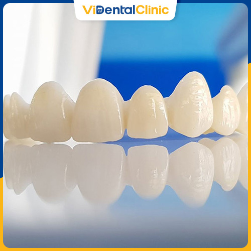 Răng toàn sứ có cấu tạo 100% sứ nguyên khối